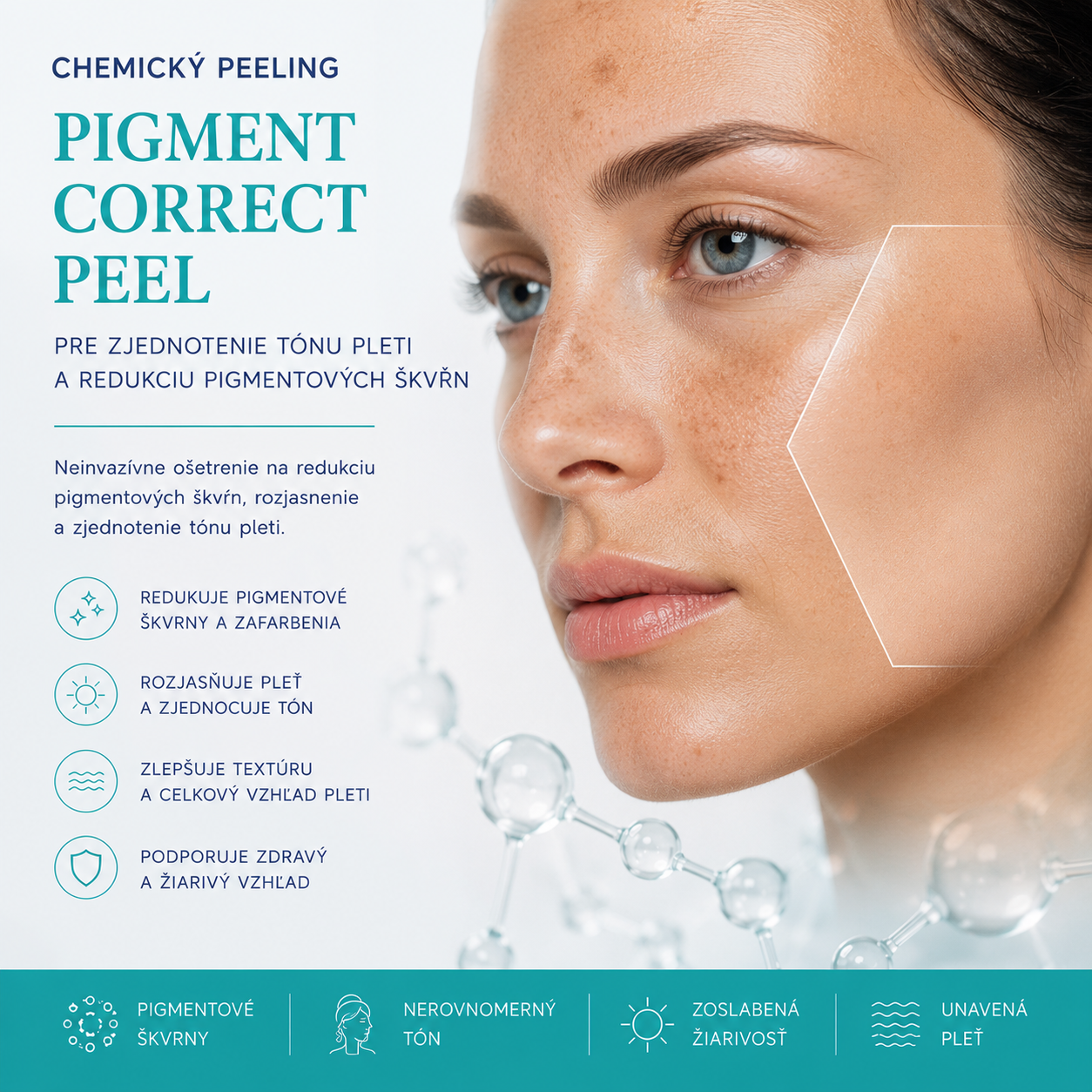 PIGMENT CORRECT PEEL