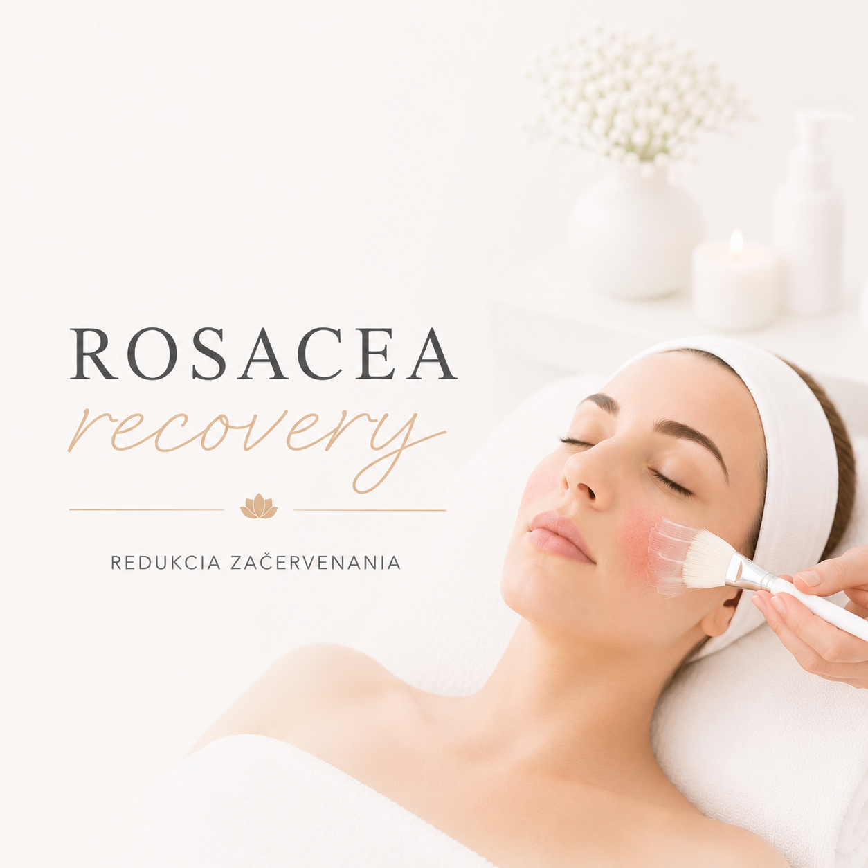 ROSACEA RECOVERY